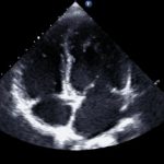 Focused Cardiac Ultrasound Course