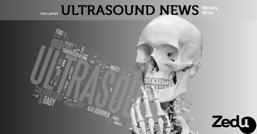 Zedu Weekly Wrap - Ultrasound nad POCUS news