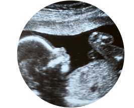 Zedu ultrasound training free baby scan - pregnant models needed