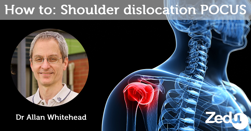 How To: Shoulder dislocation POCUS