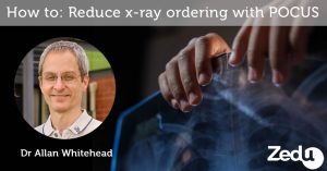 Coaching Corner - how to reduce x-ray ordering with POCUS