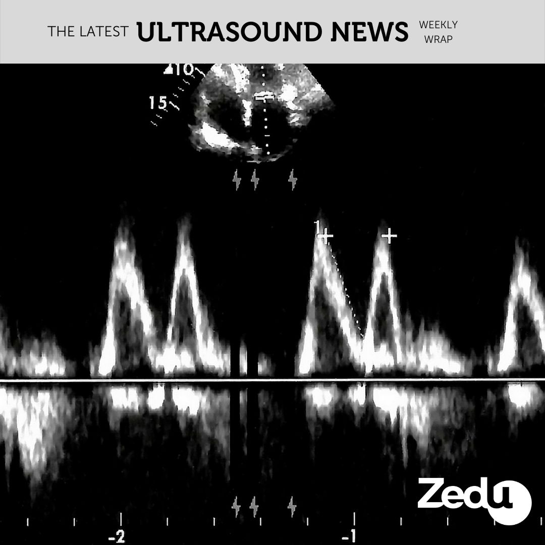 The Zedu weekly wrap - bringing together the best in free ultrasound news, views and opinions from across the internet.