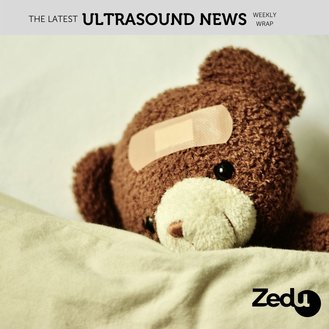 The Zedu weekly wrap - bringing together the best in free ultrasound news, views and opinions from across the internet.